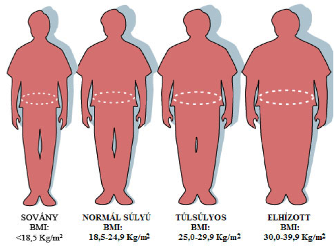 túlsúly és ízületi betegségek