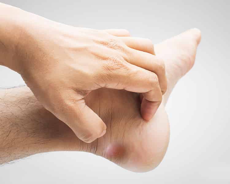 a láb interfalangeális ízületeinek ízületi kezelése ízületek ásványvíz miatt fájnak